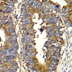 Invitrogen QARS Polyclonal Antibody 100 &mu;L; Unconjugated:Antibodies,