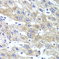 Invitrogen QARS Polyclonal Antibody 100 &mu;L; Unconjugated:Antibodies,