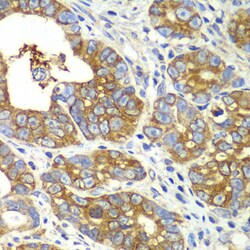 Invitrogen QARS Polyclonal Antibody 100 &mu;L; Unconjugated:Antibodies,