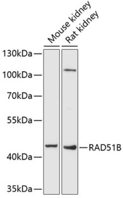 Invitrogen RAD51B Polyclonal Antibody 100 &mu;L; Unconjugated:Antibodies,