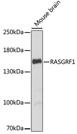 Invitrogen RASGRF1 Polyclonal Antibody 100 &mu;L; Unconjugated:Antibodies,