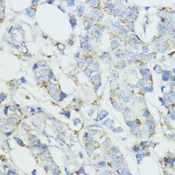 Invitrogen SOD3 Polyclonal Antibody 100 &mu;L; Unconjugated:Antibodies,