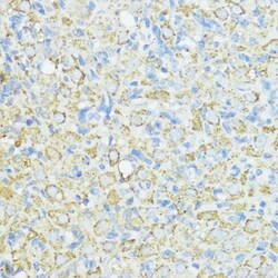 Invitrogen SOD3 Polyclonal Antibody 100 &mu;L; Unconjugated:Antibodies,