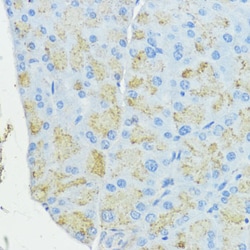 Invitrogen SOD3 Polyclonal Antibody 100 &mu;L; Unconjugated:Antibodies,