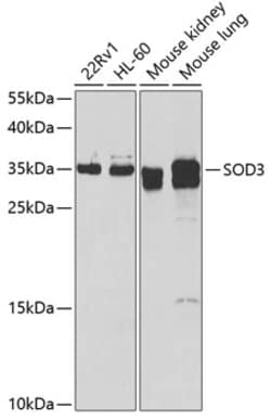 Invitrogen SOD3 Polyclonal Antibody 100 &mu;L; Unconjugated:Antibodies,