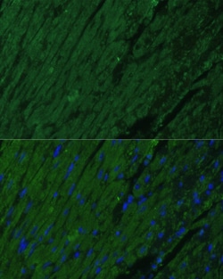 Invitrogen Cardiac Troponin I Polyclonal Antibody 100 &mu;L; Unconjugated:Antibodies,