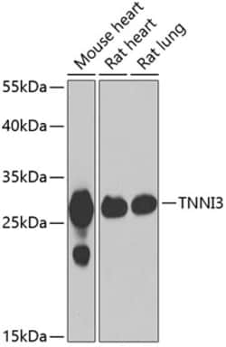 Invitrogen Cardiac Troponin I Polyclonal Antibody 100 &mu;L; Unconjugated:Antibodies,