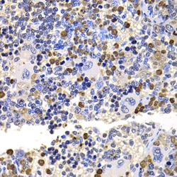 Invitrogen UBE2V2 Polyclonal Antibody 100 &mu;L; Unconjugated:Antibodies,
