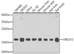 Invitrogen UBE2V2 Polyclonal Antibody 100 &mu;L; Unconjugated:Antibodies,