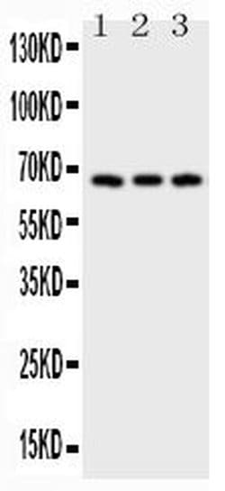 Invitrogen CD30 Polyclonal Antibody 100 &mu;g; Unconjugated:Antibodies,