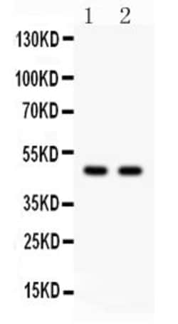 Invitrogen PTOV1 Polyclonal Antibody 100 &mu;g; Unconjugated:Antibodies,