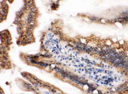 Invitrogen H-Ras Polyclonal Antibody 100 &mu;g; Unconjugated:Antibodies,