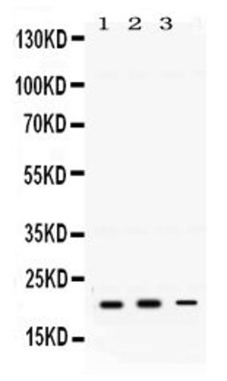 Invitrogen H-Ras Polyclonal Antibody 100 &mu;g; Unconjugated:Antibodies,