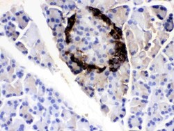 Invitrogen VIP Polyclonal Antibody 100 &mu;g; Unconjugated:Antibodies,
