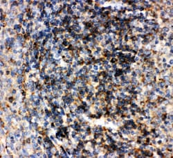 Invitrogen CD22 Polyclonal Antibody 100 &mu;g; Unconjugated:Antibodies,