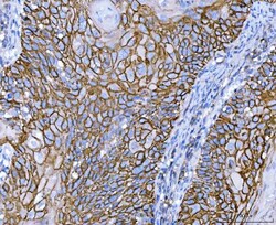 Invitrogen CD44 Polyclonal Antibody 100 &mu;g; Unconjugated:Antibodies,