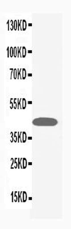 Invitrogen ERK1/ERK2 Polyclonal Antibody 100 &mu;g; Unconjugated:Antibodies,