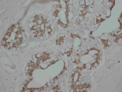Invitrogen PKC alpha Polyclonal Antibody 100 &mu;g | Buy Online | Invitrogen&trade; | Fisher Scientific