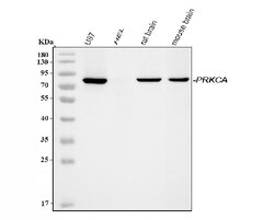 Invitrogen PKC alpha Polyclonal Antibody 100 &mu;g | Buy Online | Invitrogen&trade; | Fisher Scientific