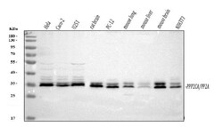 Invitrogen PP2A alpha Polyclonal Antibody 100 &mu;g | Buy Online | Invitrogen&trade; | Fisher Scientific