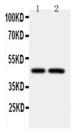 Invitrogen Caspase 2 Polyclonal Antibody 100 &mu;g; Unconjugated:Antibodies,