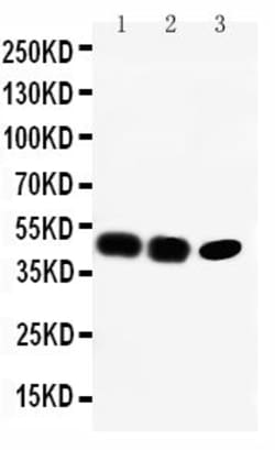 Invitrogen CCR6 Polyclonal Antibody 100 &mu;g; Unconjugated:Antibodies,
