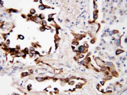 COX2 Polyclonal Antibody, Invitrogen 100 &mu;g; Unconjugated:Antibodies,