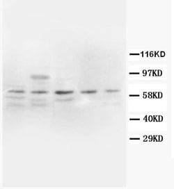 COX2 Polyclonal Antibody, Invitrogen 100 &mu;g; Unconjugated:Antibodies,