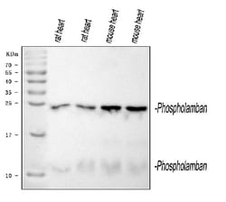 Invitrogen Phospholamban Polyclonal Antibody 100 &mu;g; Unconjugated:Antibodies,