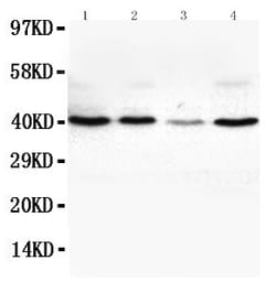 VEGFD Polyclonal Antibody:Antibodies, Polyclonal