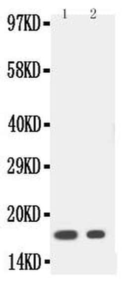 Invitrogen IL-1 beta Polyclonal Antibody 100 &mu;g; Unconjugated:Antibodies,