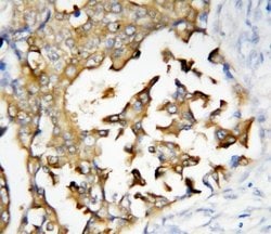 Invitrogen PSEN2 Polyclonal Antibody 100 &mu;g; Unconjugated:Antibodies,
