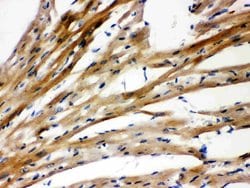 Invitrogen PSEN2 Polyclonal Antibody 100 &mu;g; Unconjugated:Antibodies,