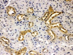 Invitrogen PSEN2 Polyclonal Antibody 100 &mu;g; Unconjugated:Antibodies,