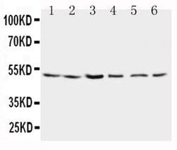 Invitrogen PSEN2 Polyclonal Antibody 100 &mu;g; Unconjugated:Antibodies,