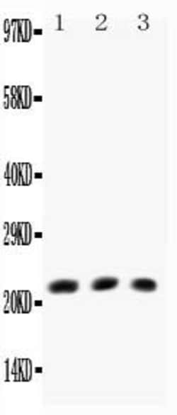 Invitrogen Human TNF beta Polyclonal Antibody 100 &mu;g; Unconjugated:Antibodies,