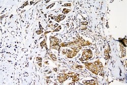 Invitrogen MEK3 Polyclonal Antibody 100 &mu;g; Unconjugated:Antibodies,