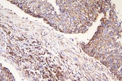 Invitrogen MEK3 Polyclonal Antibody 100 &mu;g; Unconjugated:Antibodies,