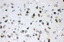 Invitrogen MEK3 Polyclonal Antibody 100 &mu;g; Unconjugated:Antibodies,