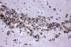 Invitrogen MEK3 Polyclonal Antibody 100 &mu;g; Unconjugated:Antibodies,
