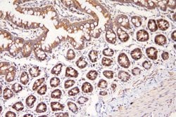 Invitrogen MEK3 Polyclonal Antibody 100 &mu;g; Unconjugated:Antibodies,