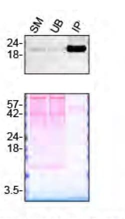 Invitrogen Pleiotrophin Polyclonal Antibody 100 &mu;g | Buy Online | Invitrogen&trade; | Fisher Scientific