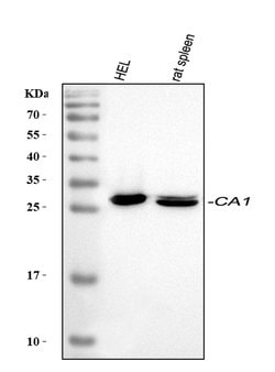 Invitrogen Carbonic Anhydrase I Polyclonal Antibody 100 &mu;g; Unconjugated:Antibodies,