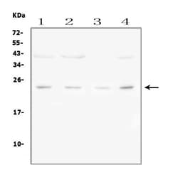 Invitrogen FGF22 Polyclonal Antibody 100 &mu;g; Unconjugated:Antibodies,