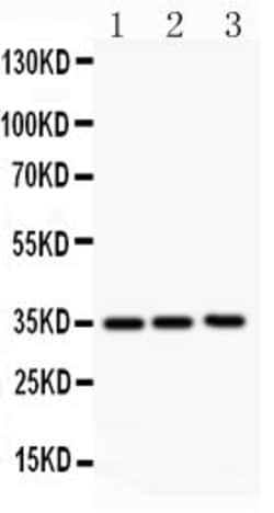 Invitrogen GM-CSF Polyclonal Antibody 100 &mu;g; Unconjugated:Antibodies,