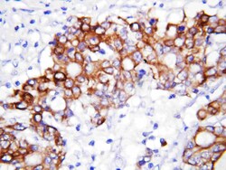 Invitrogen GCLC Polyclonal Antibody 100 &mu;g; Unconjugated:Antibodies,