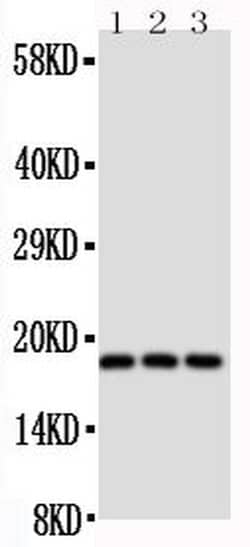 Invitrogen CD90 Polyclonal Antibody 100 &mu;g; Unconjugated:Antibodies,