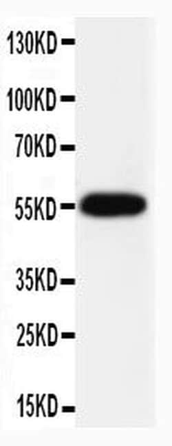 Invitrogen Caspase 8 p10 Polyclonal Antibody 100 &mu;g; Unconjugated:Antibodies,