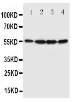 Invitrogen Fascin Polyclonal Antibody 100 &mu;g | Buy Online | Invitrogen&trade; | Fisher Scientific