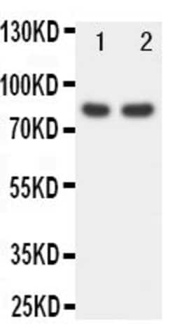 Invitrogen FOXP1 Polyclonal Antibody 100 &mu;g; Unconjugated:Antibodies,